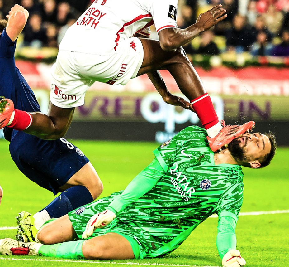 El espeluznante planchazo en el rostro que sufrió Gianluigi&nbsp;Donnarumma