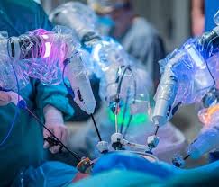 La inteligencia artificial está transformando la cirugía robótica: cuál será el próximo&nbsp;avance