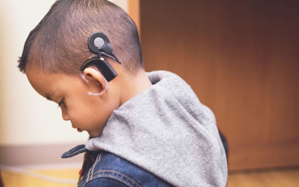 Implantes auditivos: el hospital Materno Infantil devuelve la audición a niños&nbsp;salteños