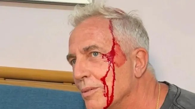 Marley sufrió un fuerte golpe en la cabeza en su visita a&nbsp;Tailandia