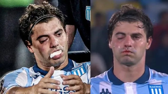 Preocupación en Racing: Santiago Sosa tiene fractura de maxilar por el golpe de Marcos Rojo y es duda para la revancha ante&nbsp;Flamengo
