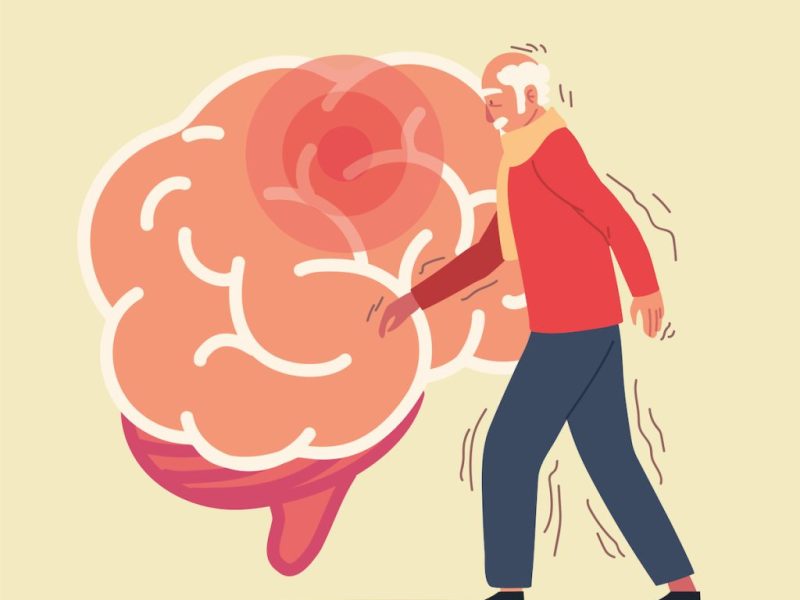 Cómo funciona el innovador tratamiento con células madre para el Parkinson aprobado en&nbsp;Japón